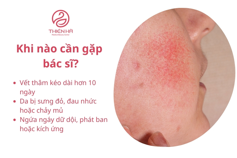 Đừng ngần ngại tham khảo ý kiến bác sĩ để đảm bảo làn da được phục hồi an toàn và đạt hiệu quả như mong muốn. Chăm sóc đúng cách và kịp thời là chìa khóa giúp bạn nhanh chóng sở hữu làn da mịn màng và đều màu hơn.