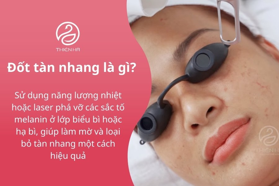 Đốt tàn nhang là phương pháp hiệu quả để lấy lại làn da trắng sáng 