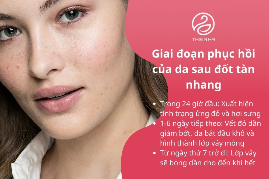 Chăm sóc kỹ lưỡng trong từng giai đoạn sẽ giúp làn da nhanh chóng phục hồi, giảm thiểu nguy cơ thâm sạm hay các vấn đề khác sau điều trị.