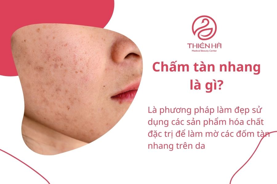 Chấm tàn nhang là phương pháp được quảng bá rất nhiều trên các diễn đàn, mạng xã hội nhưng mức độ an toàn vẫn còn đang là vấn đề khiến chúng ta đặt nhiều câu hỏi. 