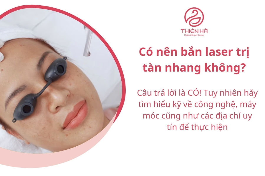 Với kinh nghiệm nhiều năm trong điều trị nám, tàn nhang, Thiên Hà khuyên bạn nên bắn laser vì hiệu quả rất cao và ít biến chứng