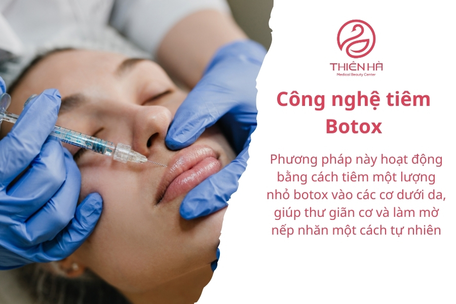 Botox thường mang lại hiệu quả kéo dài từ 4-6 tháng tùy thuộc vào cơ địa và cách chăm sóc sau điều trị. 
