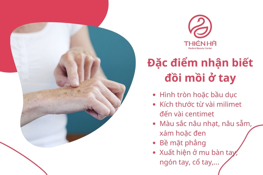 Đồi mồi rất dễ nhận biết vì kích thước và màu sắc nổi bật