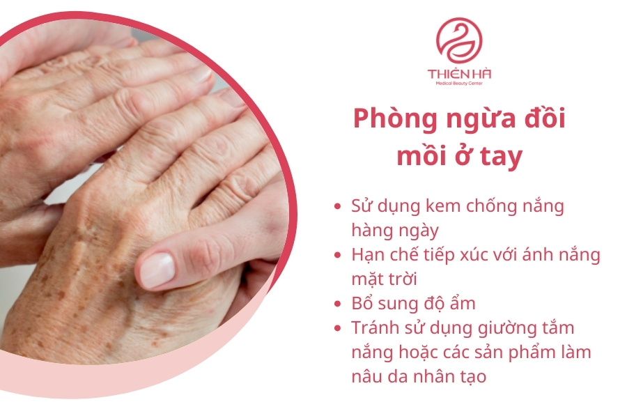 Phòng ngừa đồi mồi là một quá trình đòi hỏi sự kiên trì và chú ý hàng ngày. Với những biện pháp đơn giản nhưng hiệu quả này, bạn có thể bảo vệ đôi tay mình khỏi các dấu hiệu lão hóa không mong muốn và duy trì làn da tươi trẻ theo thời gian.