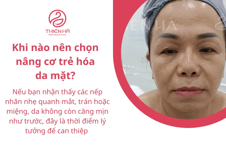 Trước khi thực hiện bất kỳ liệu trình nào, hãy tham khảo ý kiến của các chuyên gia da liễu hoặc thẩm mỹ để được tư vấn phương pháp phù hợp nhất với tình trạng da và nhu cầu cá nhân.