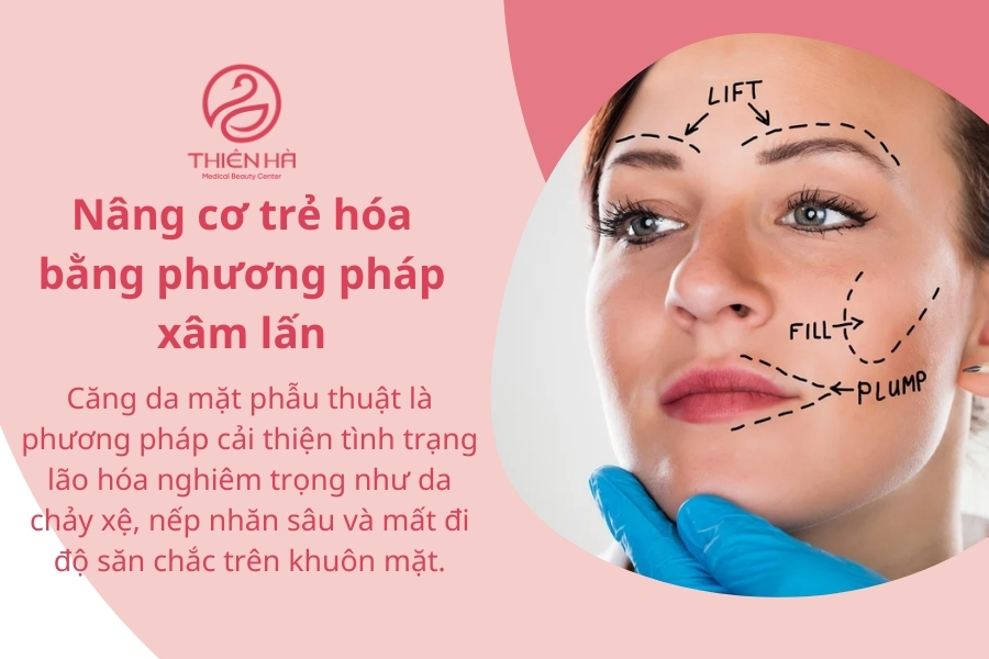 Nâng cơ xâm lấn chỉ nên sử dụng trong trường hợp lão hóa nặng 