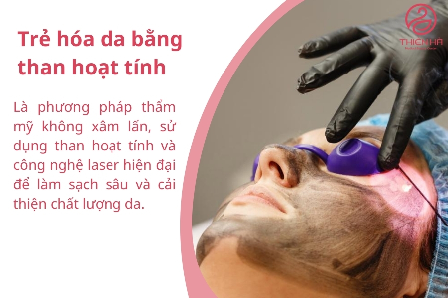 Phương pháp này còn được biết đến với những tên gọi khác như “Laser Carbon” hoặc “bắn than hoạt tính”.