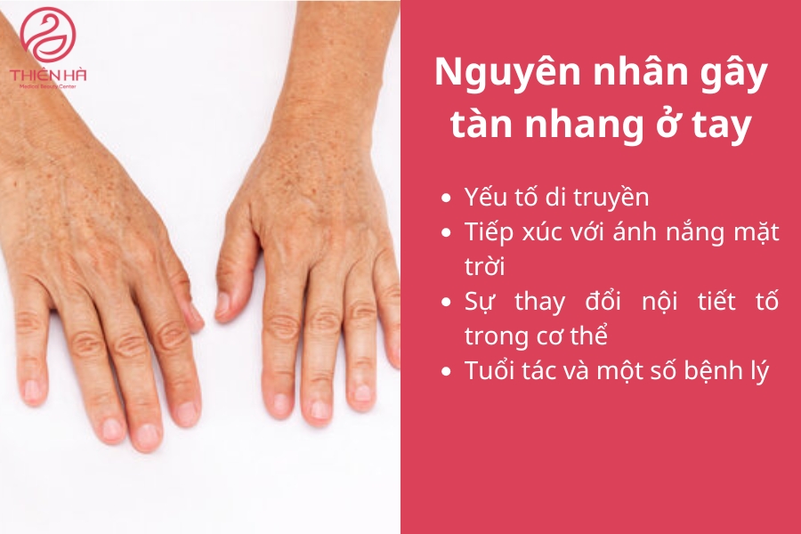 Hiểu rõ các nguyên nhân trên sẽ giúp bạn lựa chọn phương pháp phòng ngừa và điều trị phù hợp, bảo vệ làn da tay khỏi các đốm nâu phiền toái.