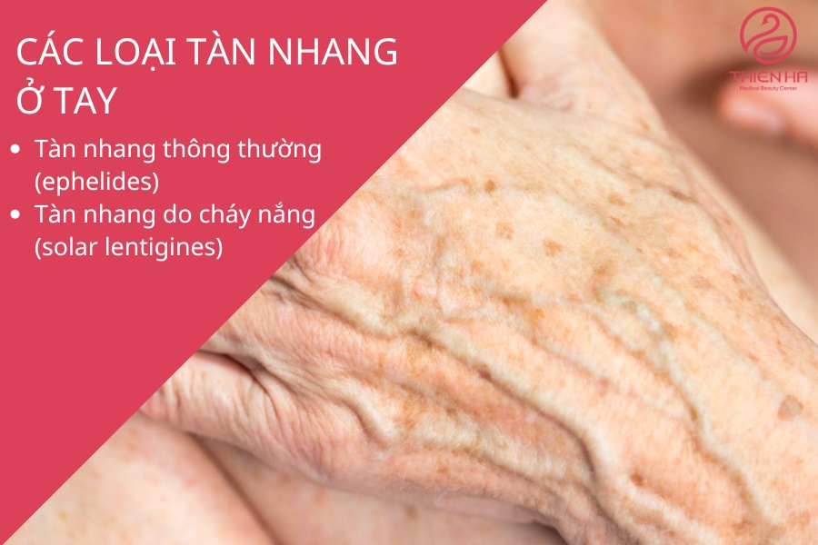 Việc nhận biết loại tàn nhang ở tay là bước đầu tiên quan trọng giúp bạn lựa chọn phương pháp điều trị phù hợp và đạt hiệu quả cao.