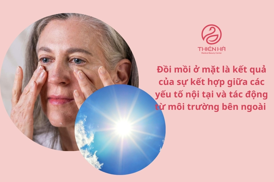 Hiểu rõ nguyên nhân gây đồi mồi không chỉ giúp bạn tìm ra cách điều trị hiệu quả mà còn giúp bạn có những biện pháp phòng ngừa phù hợp, bảo vệ làn da khỏe mạnh lâu dài.