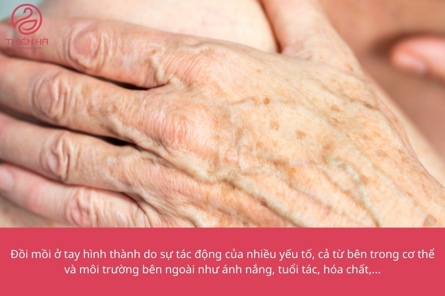 Những yếu tố này phối hợp với nhau, tạo nên những dấu hiệu không mong muốn trên đôi tay, khiến chúng ta phải tìm kiếm các biện pháp khắc phục hiệu quả.