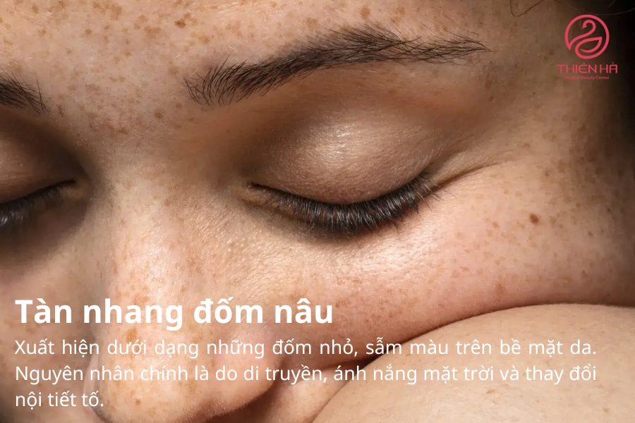 Việc hiểu rõ đặc điểm và nguyên nhân giúp bạn dễ dàng xác định phương pháp điều trị và chăm sóc da phù hợp để giảm thiểu tình trạng này.