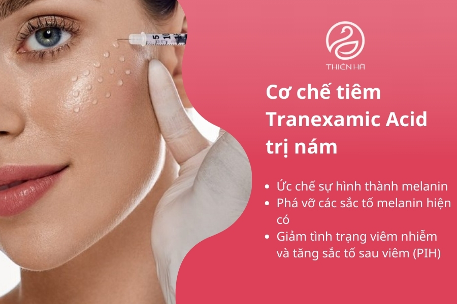 Tiêm Tranexamic Acid vượt trội hơn nhờ khả năng đưa hoạt chất đến đúng lớp trung bì, nơi nám hình thành, giúp cải thiện sắc tố nhanh chóng và an toàn.