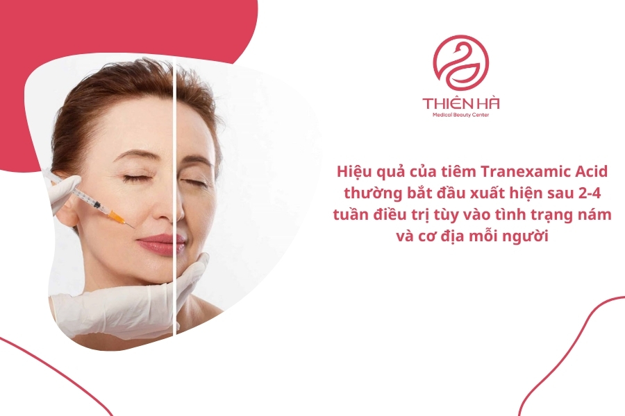Nhờ cơ chế hoạt động khoa học và khả năng tác động nhanh chóng, tiêm Tranexamic Acid là giải pháp hiệu quả, an toàn và phù hợp cho những trường hợp nám cứng đầu hoặc nám lâu năm.