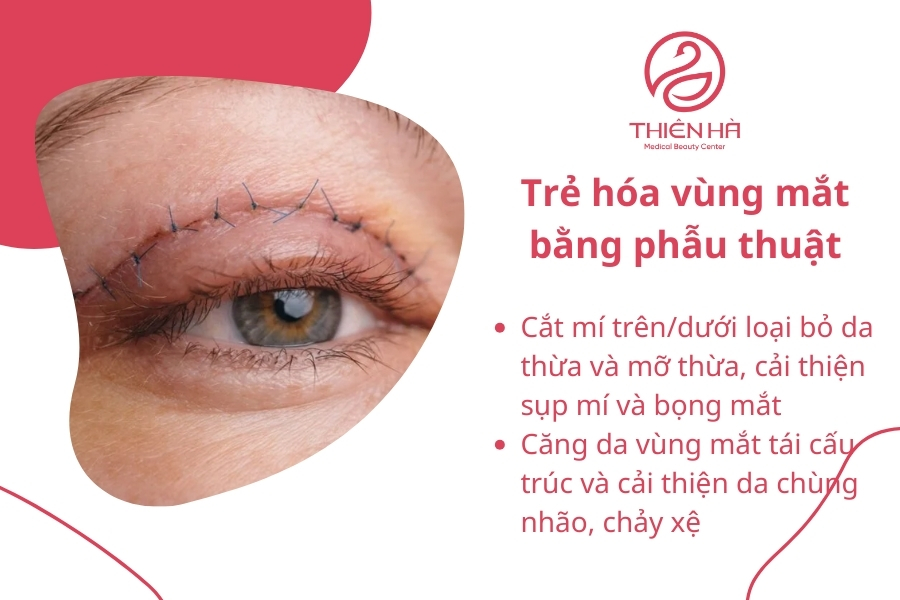 Mỗi phương pháp trẻ hóa vùng mắt có ưu và nhược điểm riêng. Tùy thuộc vào nhu cầu và tình trạng da, bạn có thể lựa chọn giải pháp phù hợp để lấy lại ánh nhìn tươi trẻ và rạng rỡ.
