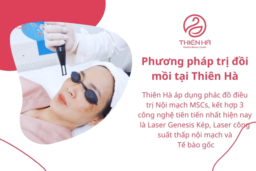 Hãy để Thiên Hà Medical Beauty Center đồng hành cùng bạn trên hành trình xóa mờ đồi mồi, lấy lại làn da khỏe đẹp, rạng rỡ hơn từng ngày!