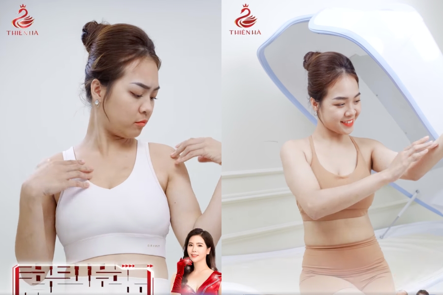 Hình ảnh khách hàng trước (bên trái) và sau (bên phải) tắm trắng tại Thiên Hà. Có thể thấy được sự thay đổi rõ rệt về tông da và độ mịn của da.