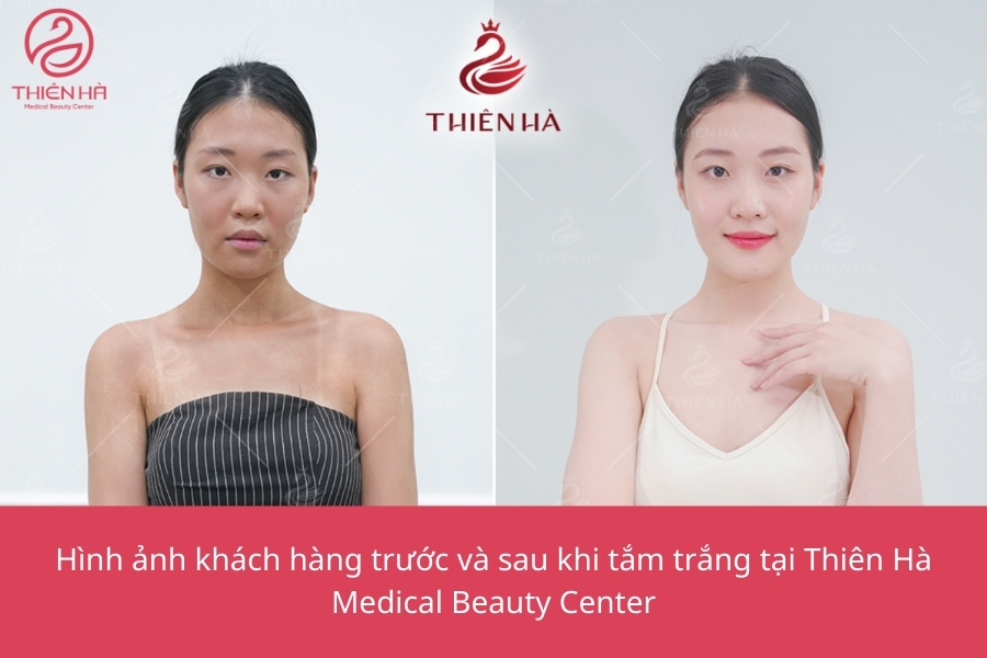 Hãy để Thiên Hà đồng hành cùng bạn trên hành trình nâng tầm làn da, giúp bạn tự tin tỏa sáng trong mọi khoảnh khắc. 