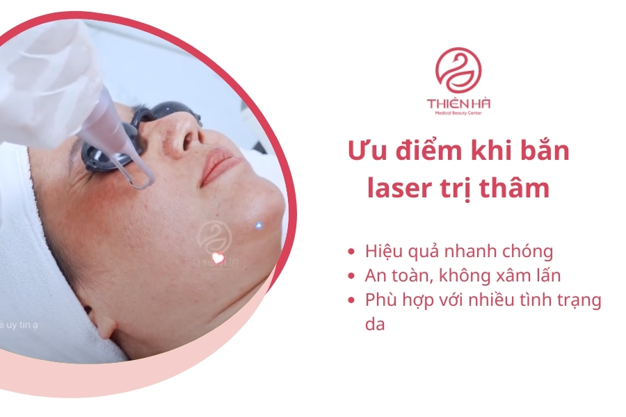 Ưu điểm nổi bật nhất của bắn laser trị thâm là sự an toàn