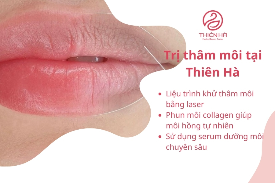 Các liệu trình trị thâm môi bằng công nghệ cao tại Thiên Hà 
