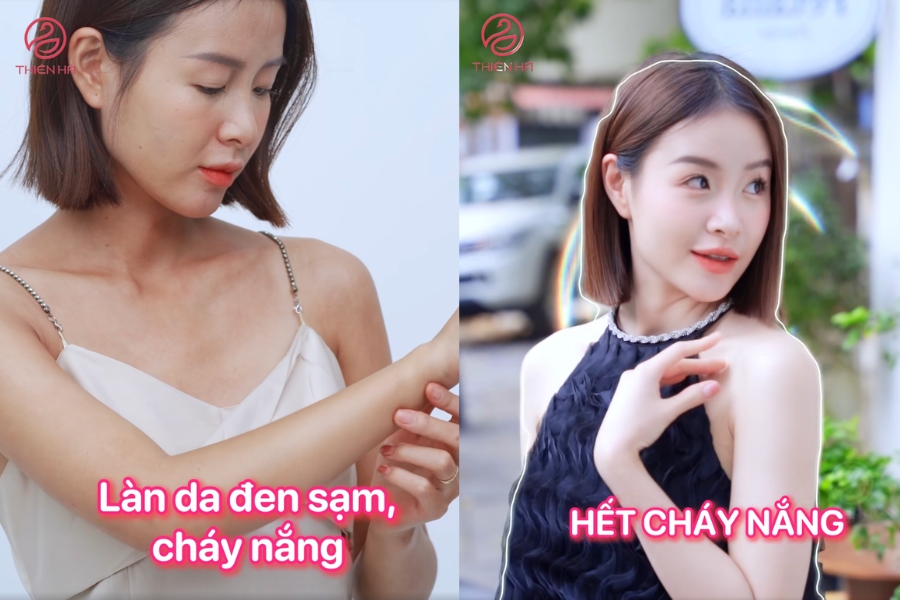Hình ảnh khách hàng trước và sau khi tắm trắng tại Thiên Hà