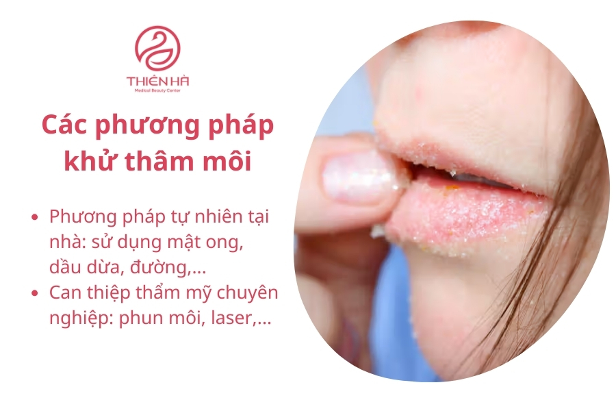 Phương pháp khử thâm môi có nhiều loại phù hợp với tình trạng của mỗi cá nhân 