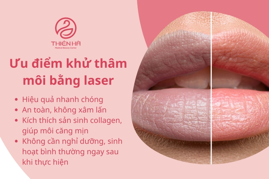 Với những ưu điểm vượt trội này, khử thâm môi bằng laser trở thành lựa chọn lý tưởng cho những ai muốn sở hữu đôi môi hồng hào mà không cần phun xăm.