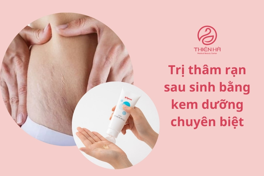 Kem dưỡng trị thâm cũng là sự lựa chọn phù hợp với nhiều mẹ bỉm bị thâm sạm 