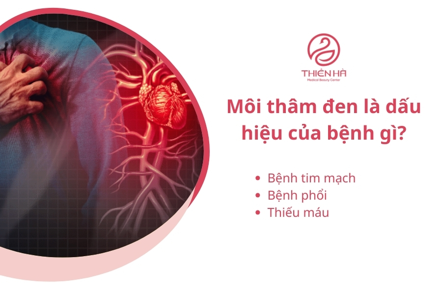 Một vài loại bệnh có thể gây ra tình trạng môi bị thâm tím 