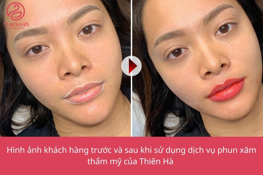 Phun môi giúp khắc phục tình trạng môi bị thâm tím