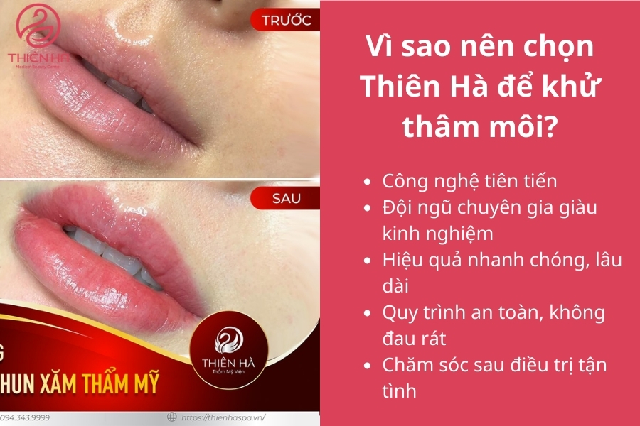 Thiên Hà sở hữu nhiều công nghệ hiện đại giúp bạn lấy lại đôi môi hồng hào chỉ sau 1 liệu trình 