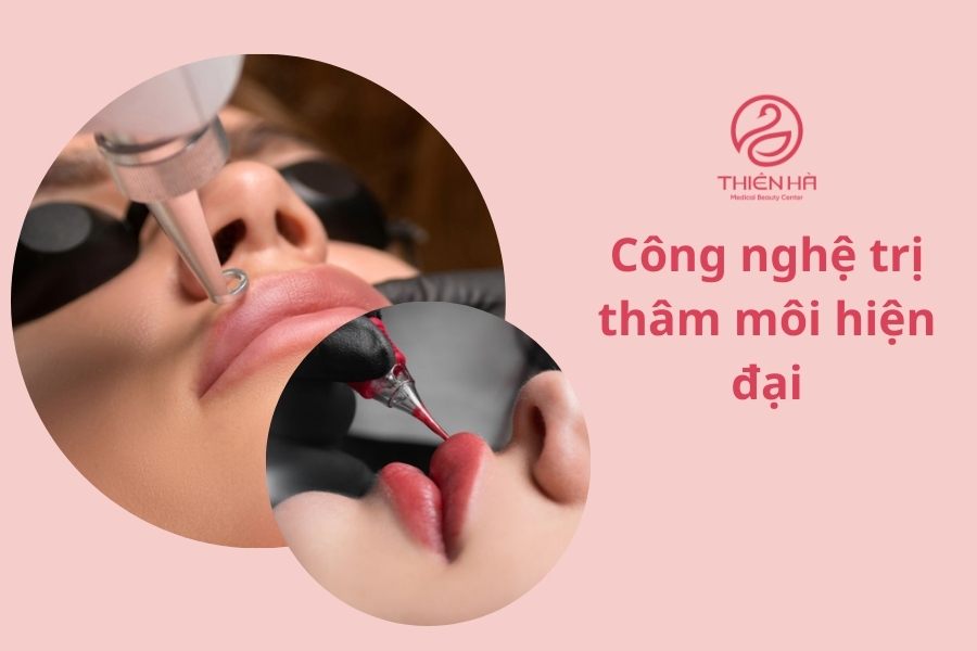 Công nghệ trị thâm là giải pháp hữu hiệu