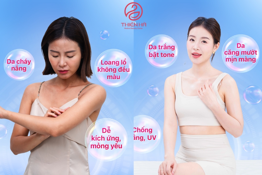 Hình ảnh khách hàng trước và sau khi tắm trắng tại Thiên Hà