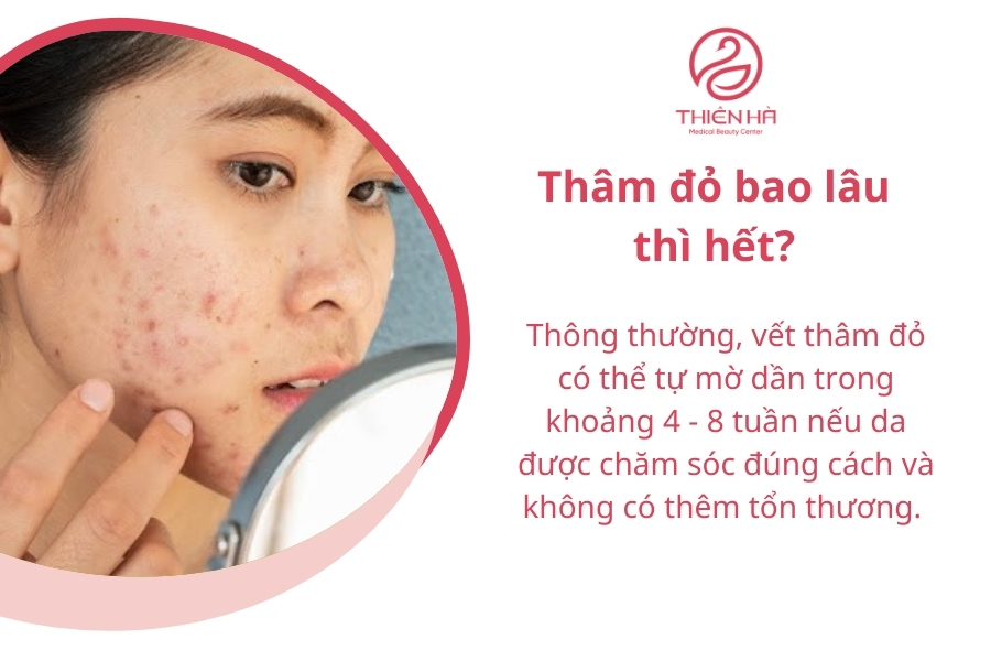 Thâm đỏ có thể tự hết nếu chăm sóc đúng cách 