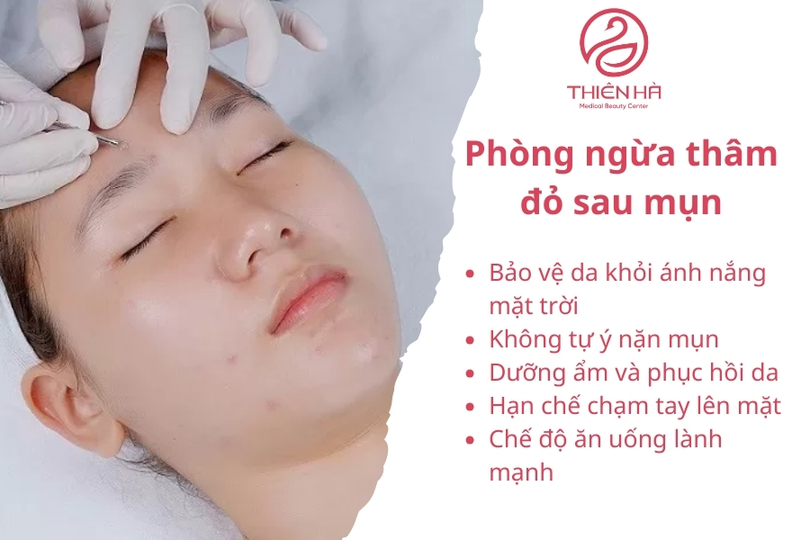 Để phòng ngừa thâm đỏ bạn hãy chú ý chống nắng 
