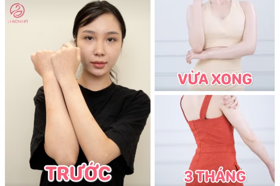Kết quả tắm trắng công nghệ cao tại Thiên Hà Medical Beauty Center 