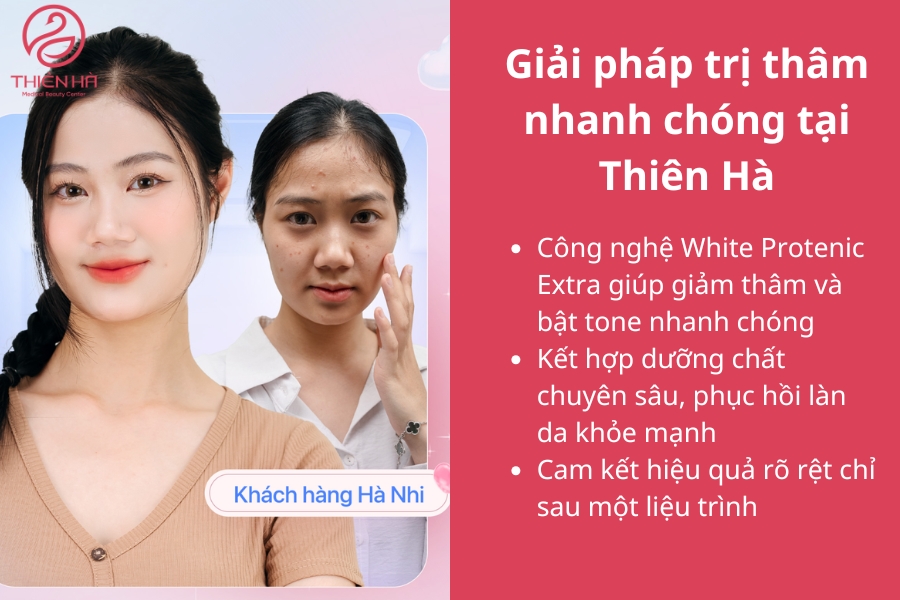 Thiên Hà sở hữu nhiều công nghệ trị thâm hiện đại bậc nhất