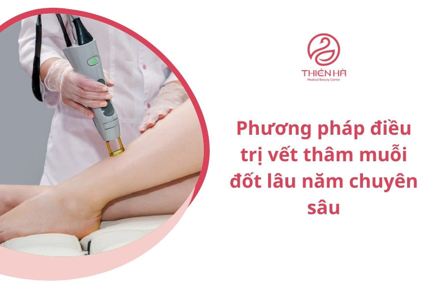 Các biện pháp công nghệ cao phù hợp nhất với người có vết thâm muỗi đốt lâu năm 
