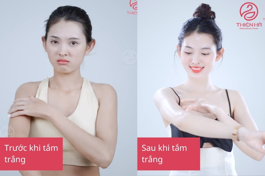 Tình trạng khách hàng trước và sau khi tắm trắng tại Thiên Hà