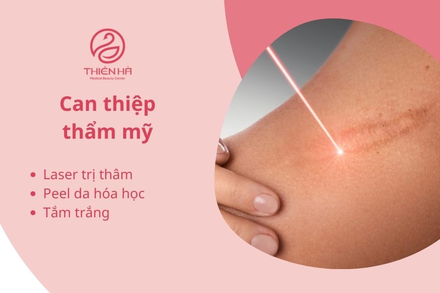 Thâm lâu năm có thể can thiệp bằng laser 