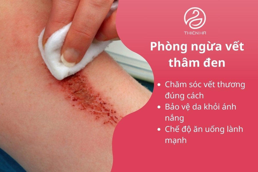 Chăm sóc kỹ càng vết thương sẽ hạn chế được thâm 