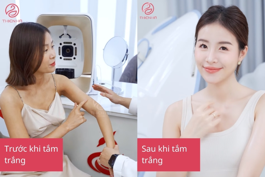Hình ảnh khách hàng sau khi tắm trắng 
