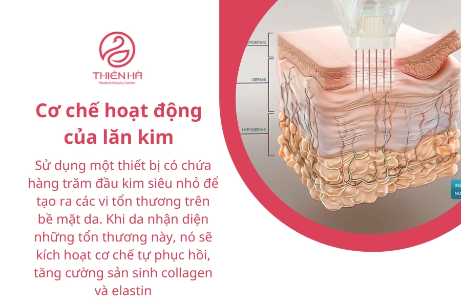 Cơ chế hoạt động của lăn kim