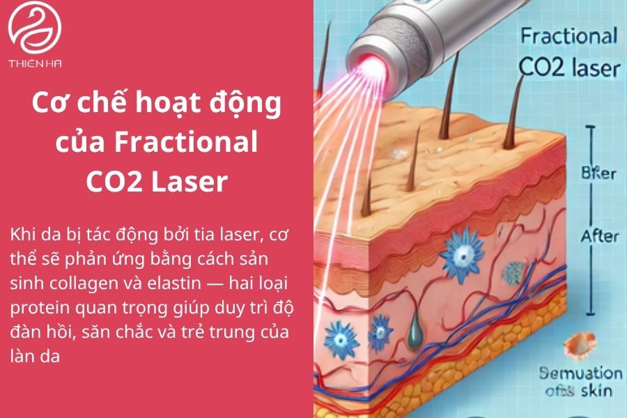 Cơ chế hoạt động của Laser CO2 Fractional