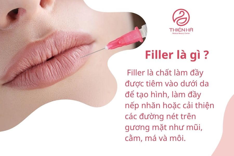 Filler là gì và tại sao cần làm tan filler?
