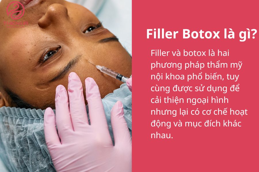 Filler Botox là gì?