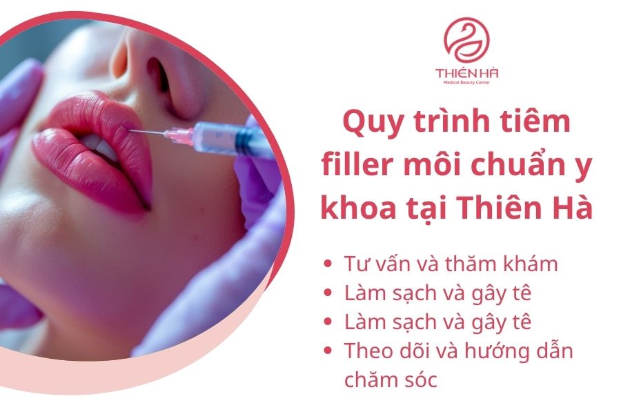 Quy trình tiêm filler môi chuẩn y khoa tại Thiên Hà