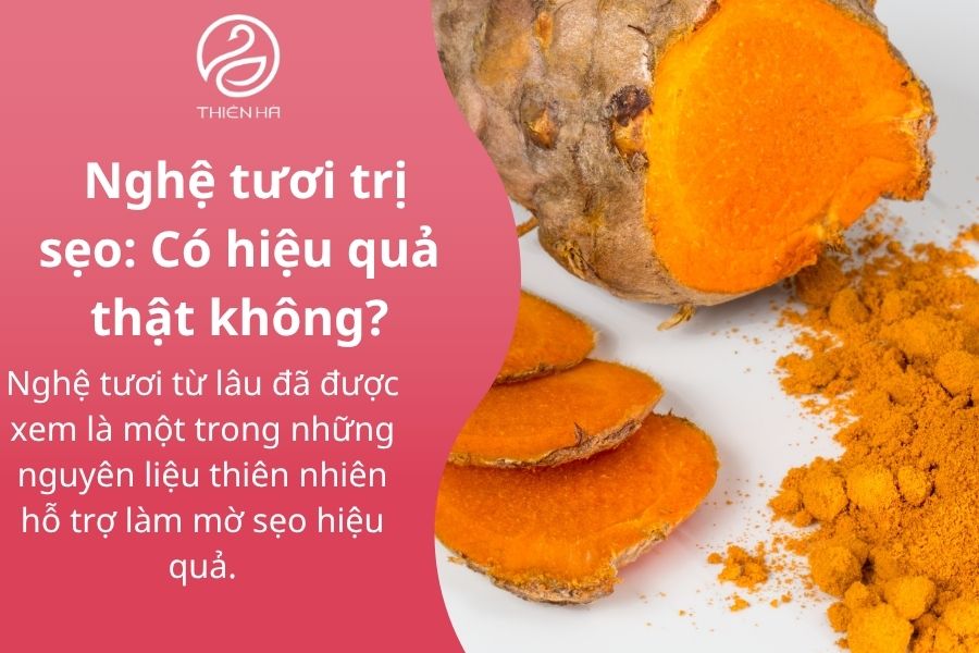 Nghệ tươi trị sẹo: Có hiệu quả thật không?