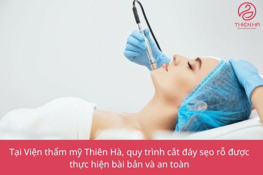 Quy trình cắt đáy sẹo rỗ tại Viện thẩm mỹ Thiên Hà
