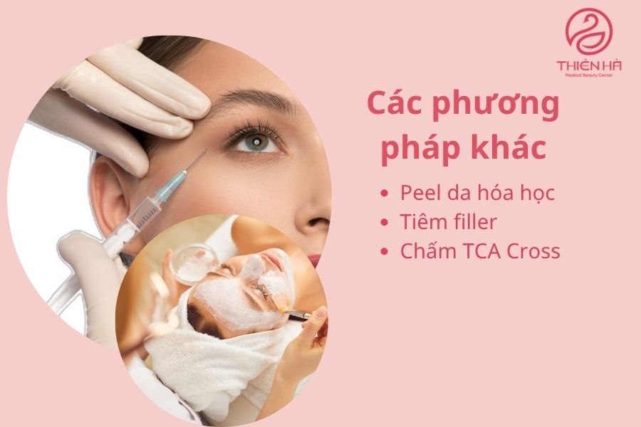 Một số phương pháp khác